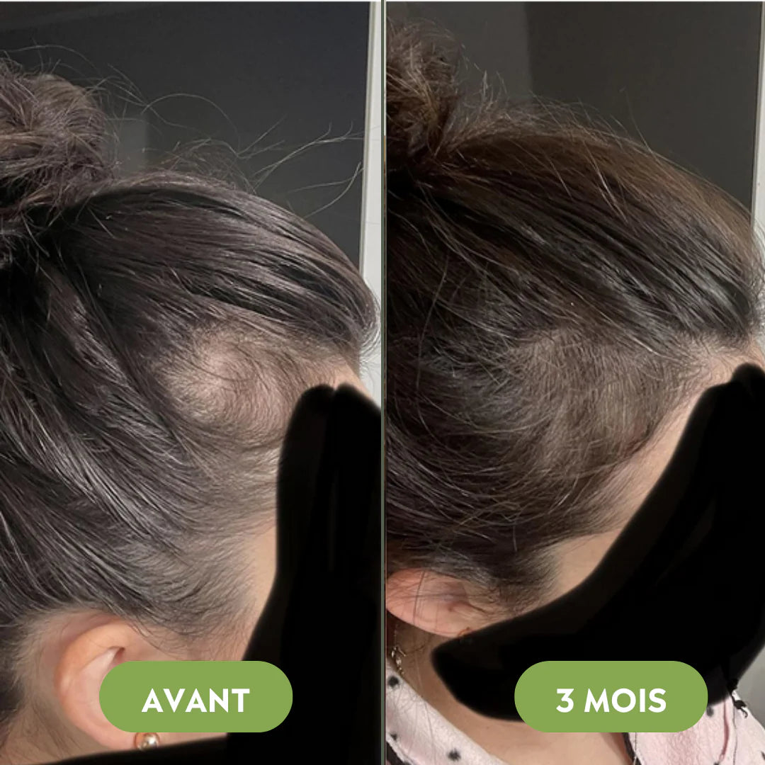 Hair growth serum (60ml)