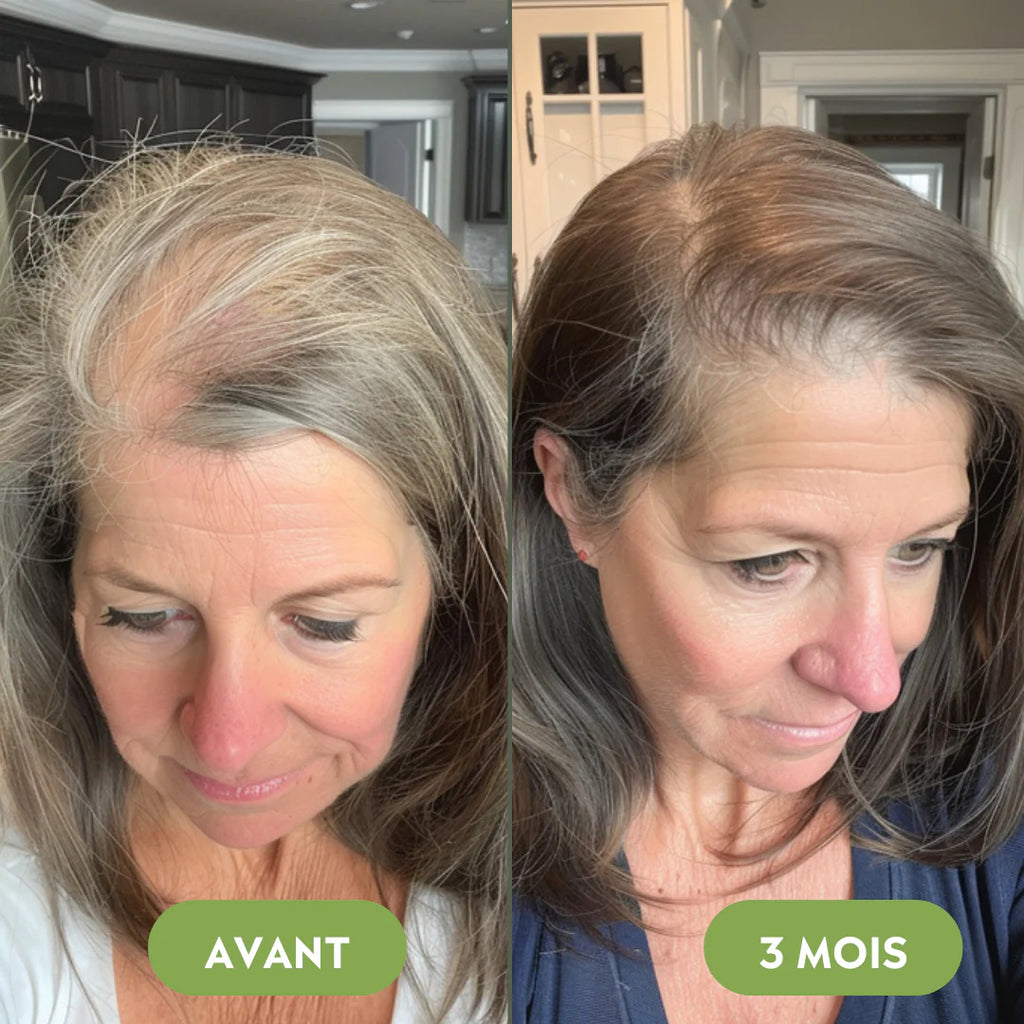 Hair growth serum (60ml)