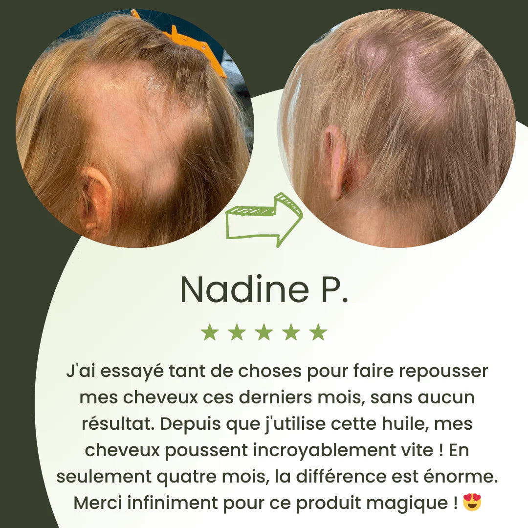 Hair growth serum (60ml)